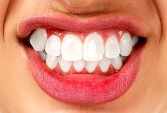 Diş Sıkma – Diş Gıcırdatma
